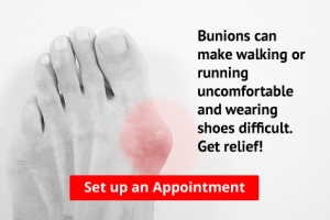 Are Bunions Affecting Your Everyday Life?