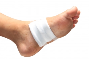 Stages of Wound Healing